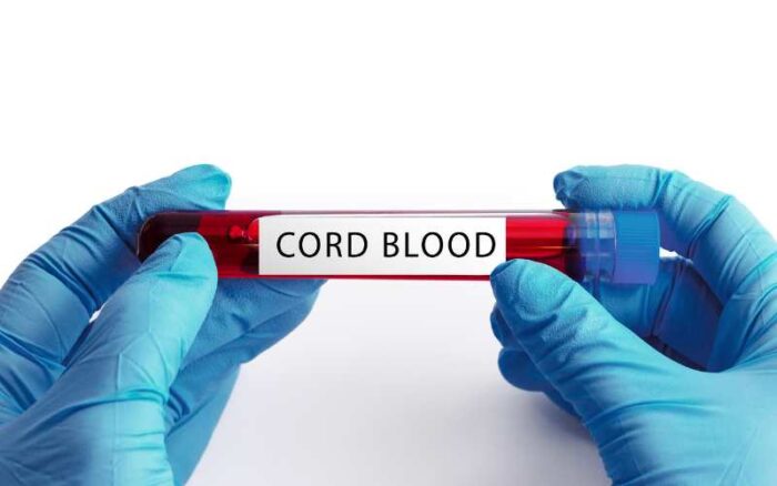 umbilical cord stem cell banking